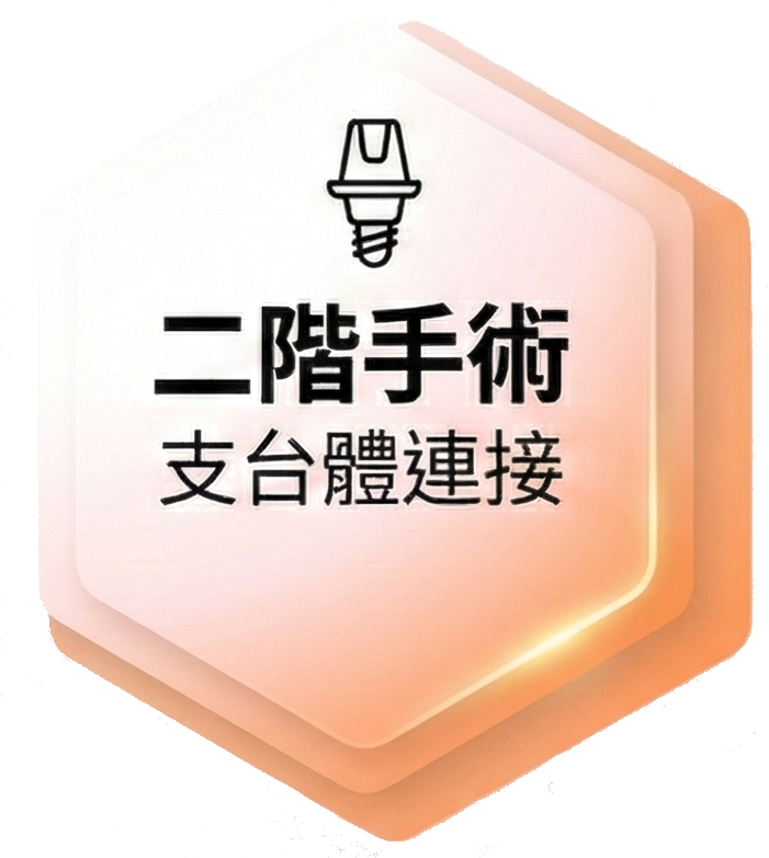 二階手術支台體連接