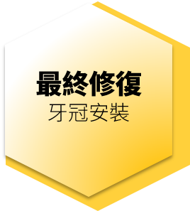 最終修復