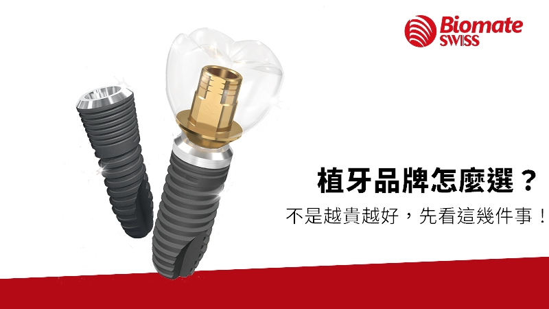 conparison-of-dental-implant.jpg