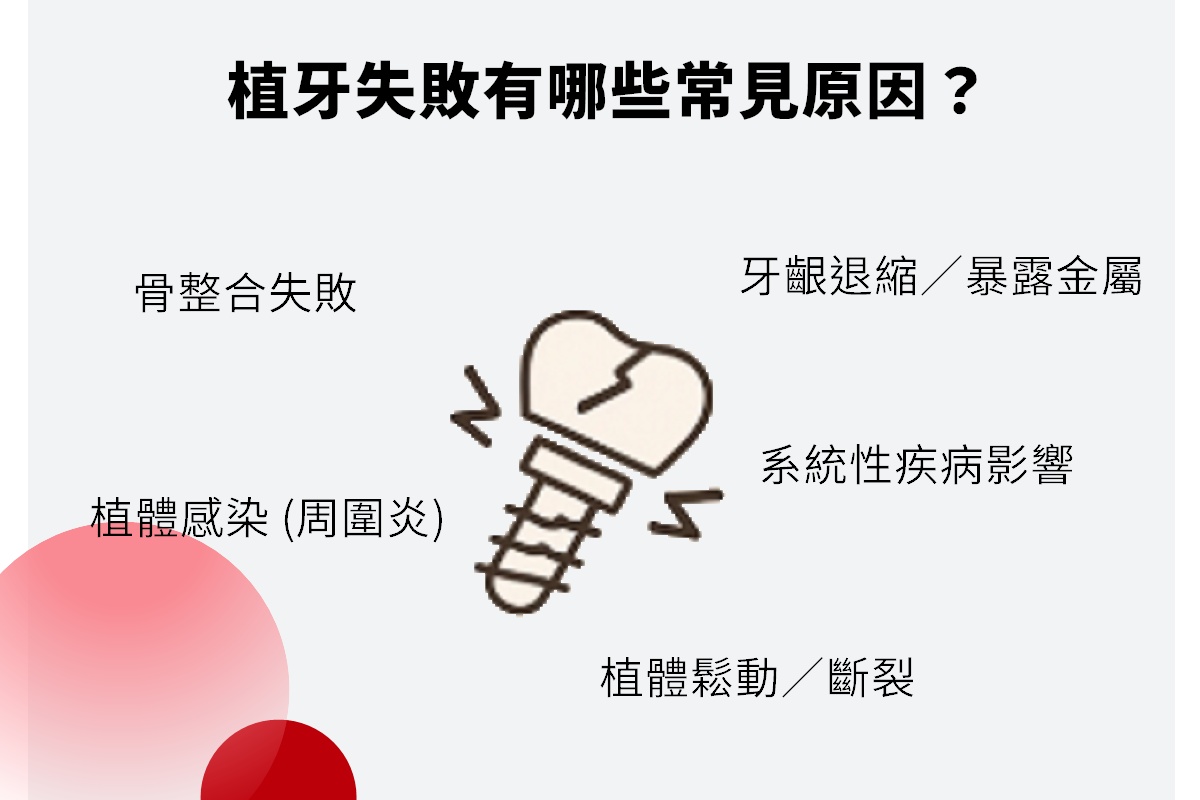 植牙失敗常見原因