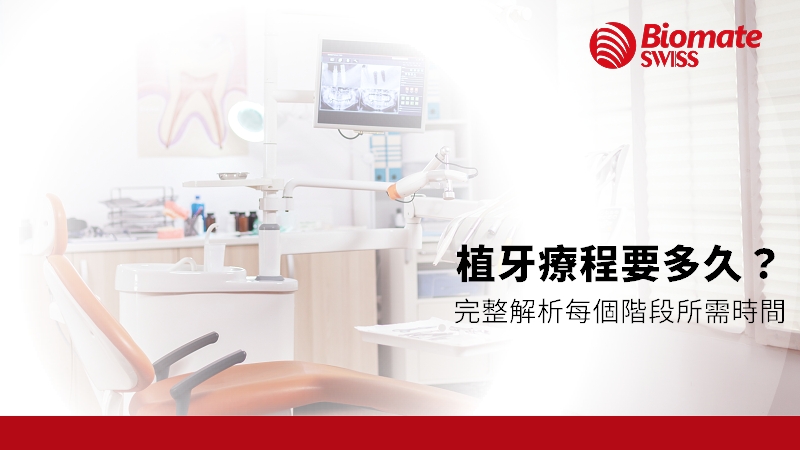 how-long-do-dental-implants-take.jpg