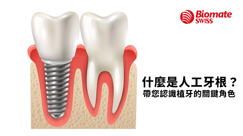 what-is-dental-implant.png