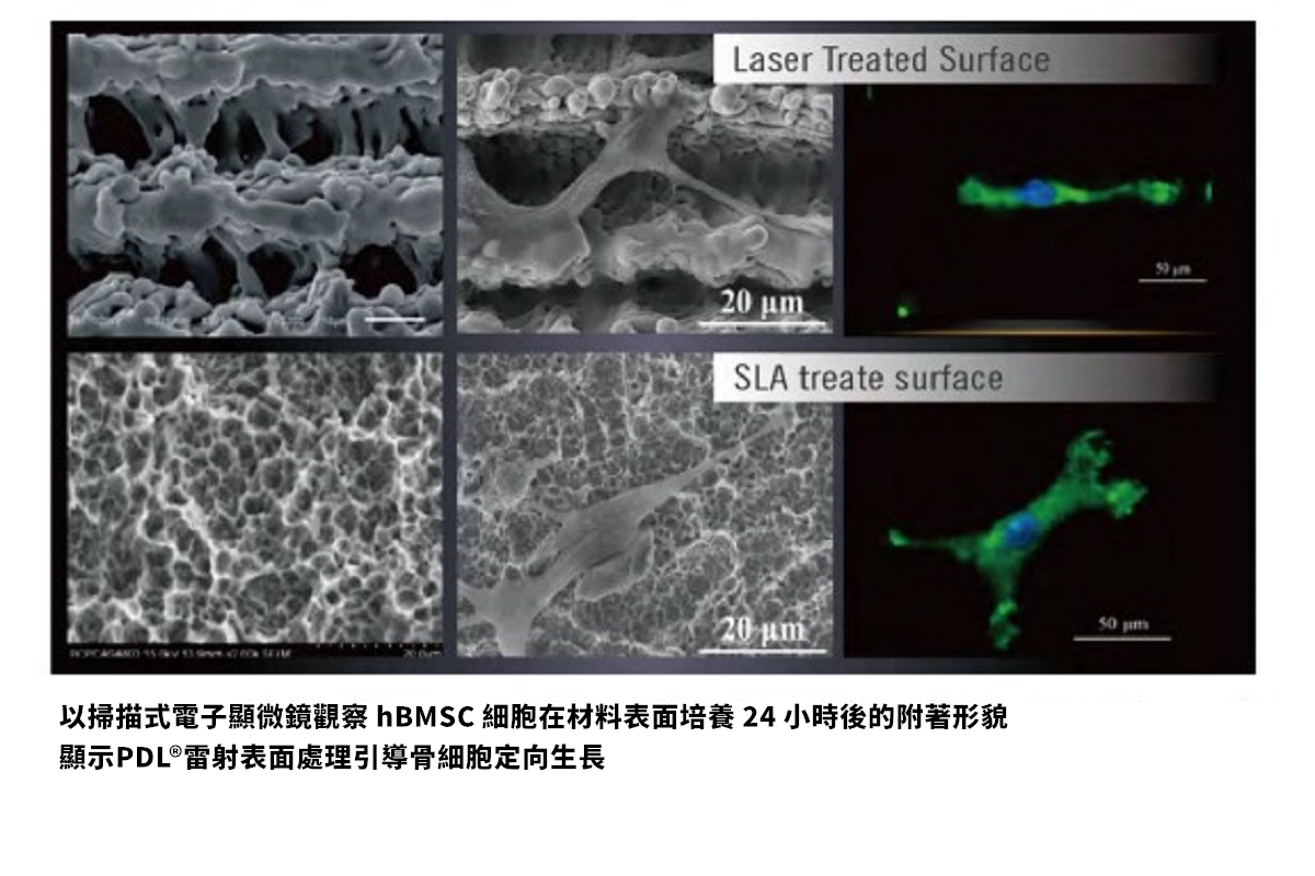 PDL雷射表面處理引導骨細胞定向生長
