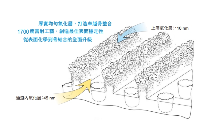 PDL® 雷射處理植體表面形成上下層厚實TiO₂氧化層（上層110nm、通道內45nm），全面提升骨整合與表面穩定性