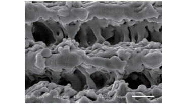 20微米下雷射植體