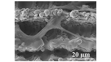 20微米下雷射植體